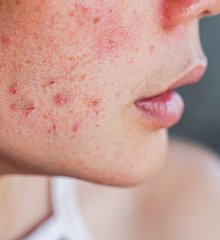 Resize-iStock-1270415883